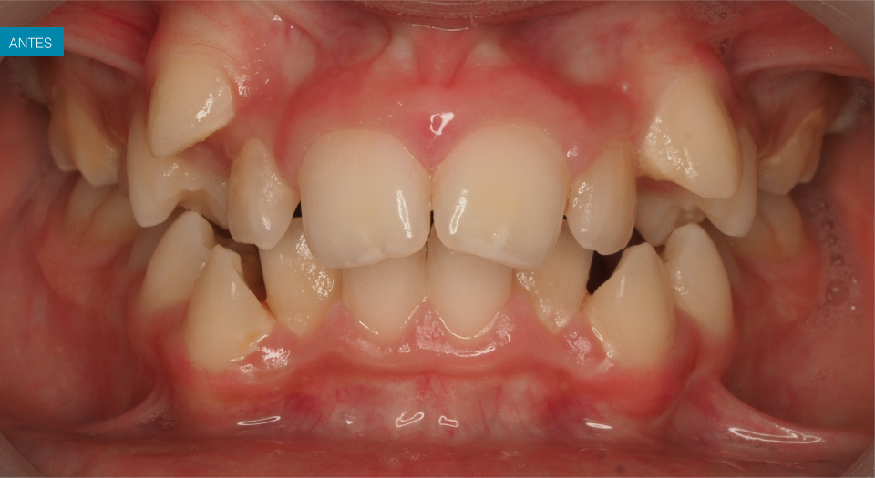 Ortodontia - Caso clínico 2 #1