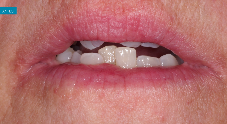 Ortodontia - Caso clínico 3 #4