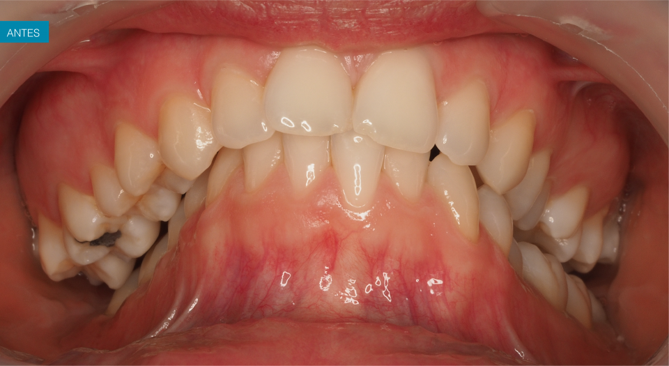 Ortodontia - Caso clínico 4 #2